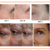Results Testimonies
